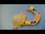 Нейлоновые зубные протезы фото